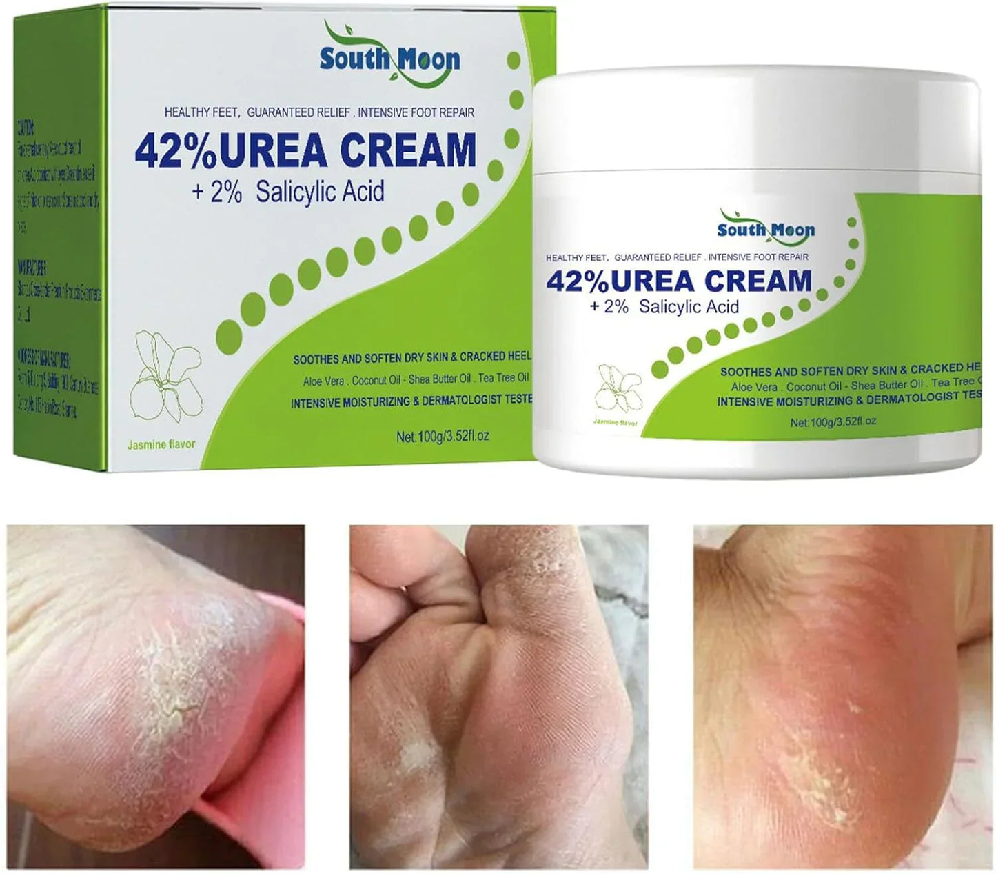 South Moon 42% Urea Cream with 2% Salicylic Acid for dry, rough skin, shown in a jar with creamy texture and smooth application.