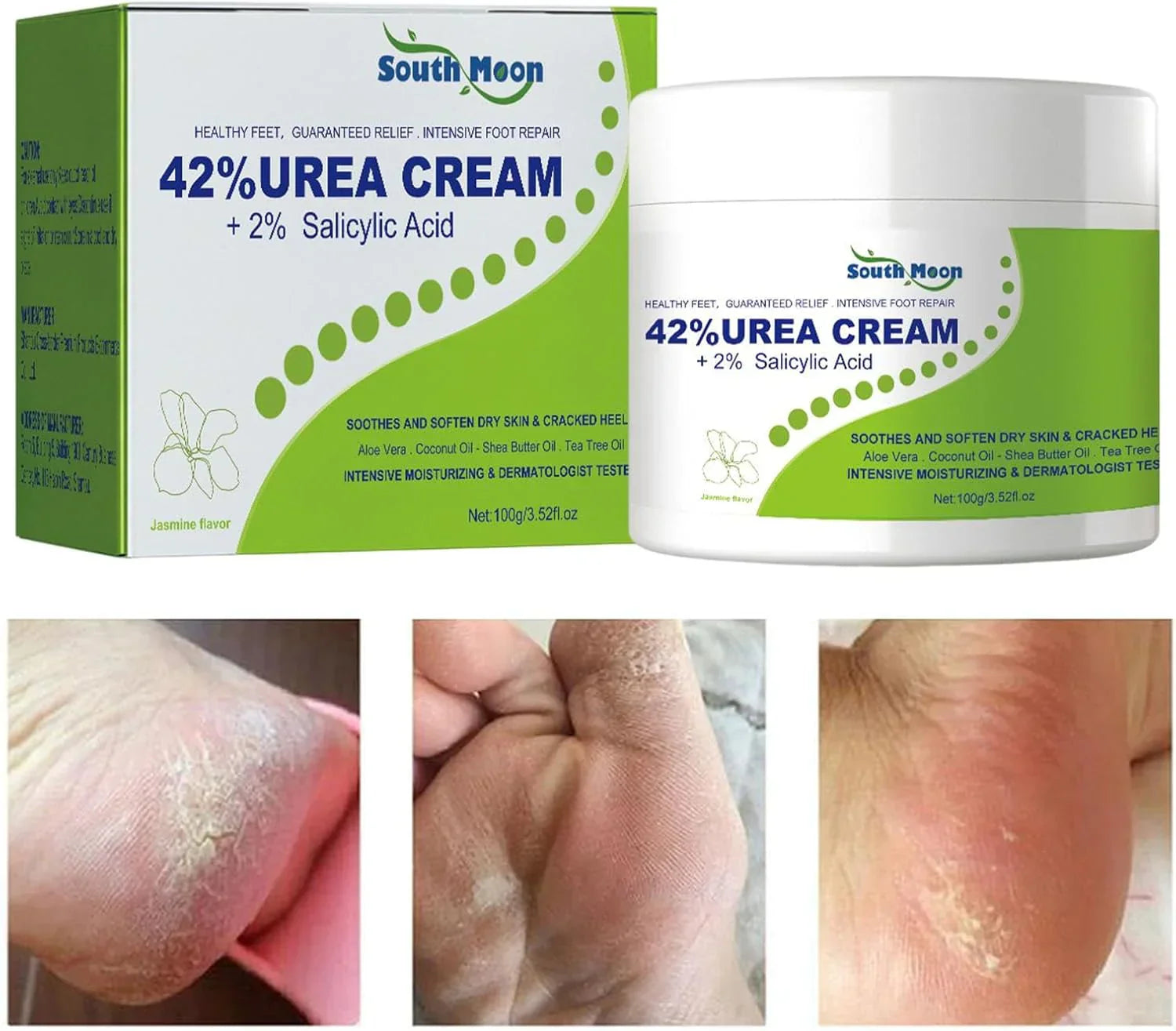 South Moon 42% Urea Cream with 2% Salicylic Acid for dry, rough skin, shown in a jar with creamy texture and smooth application.